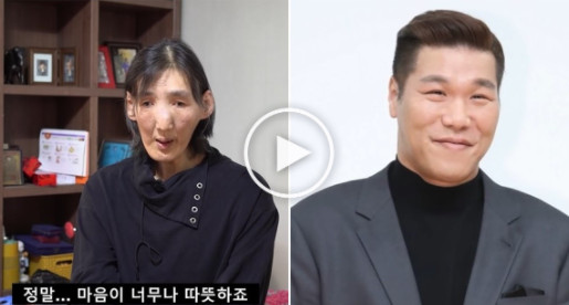 농구선수 김영희 205cm 거인병 말단비대증 투병 서장훈 <b>허재</b> 돈... 