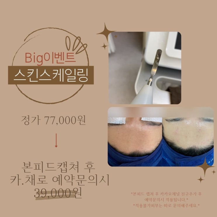  부천 신중동 피부관리실 스킨스케일링 빅이벤트1탄 혜택받는 방법