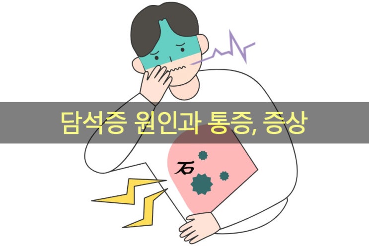  담석증 원인과 통증, 증상, 좋은 음식 그리고 영양제