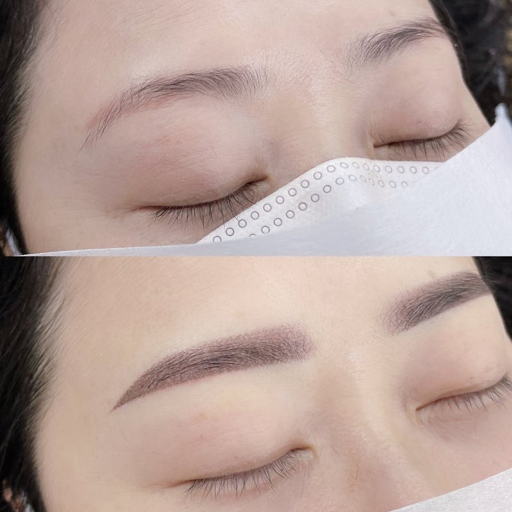  천안눈썹문신, 켈로이드 피부일때 반영구를 받아도 될까요?