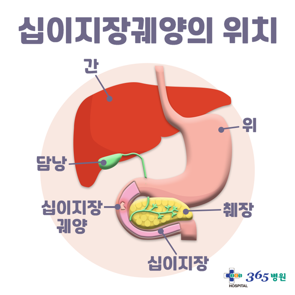 [창원마산 척추관절 디스크 365병원] 십이지장염·궤양