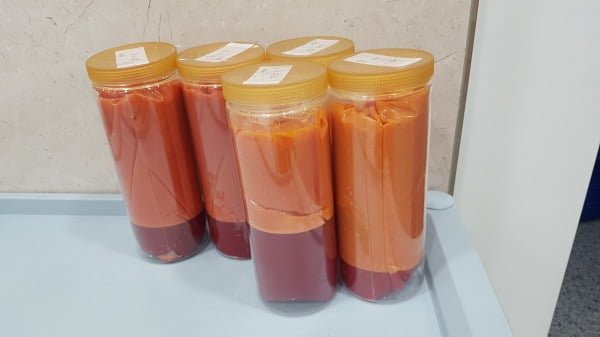 인체 폐지방 1kg 2억 금보다 비싸다 지방흡입 후 돈벌 수 있다고 재활용 폐지방 법 인체 폐지방 1kg 2억 금보다 비싸다 지방흡입 후 돈벌 수 있다고 재활용 폐지방 법