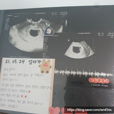  [ 태교 일기 3편 ] 5 ~ 7주의 기록, 임신 초기 증상, 아기집 발견, 산부인과 병원 정하기, 예비 호랑이띠 아빠