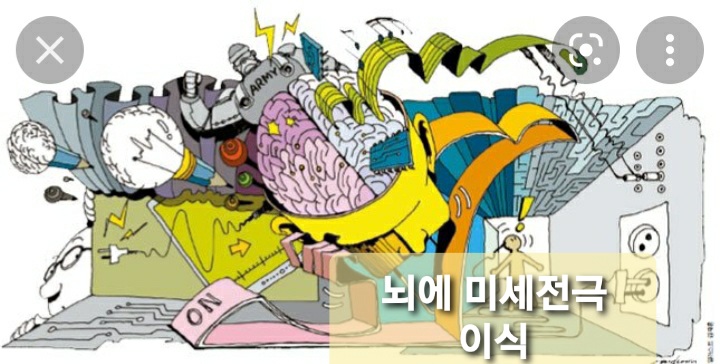  뇌에 미세전극 이식… 16년 만에 시력 찾았다