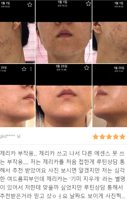  <옴므특집> 남자도 피부를 관리합시다 , 남자피부관리 꿀팁