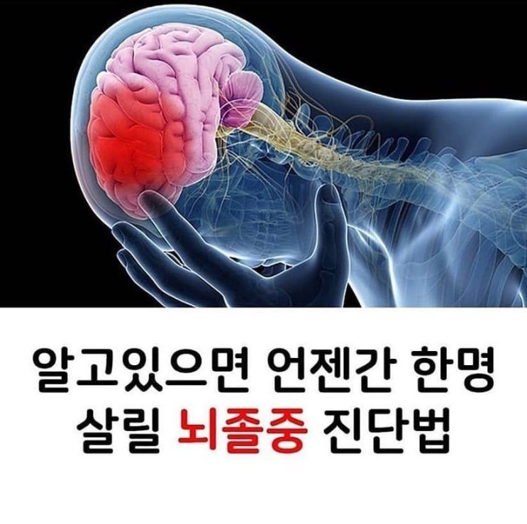 혈관 혈액 청소 좋은 음식 그리고 좋은 운동 헌혈 봉사자가 알려드릴게요 고지혈증 원인 중성지방(LDL 콜레스테롤) 낮추고 불포화지방산 섭취 증가