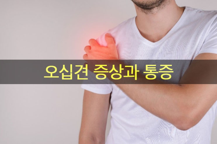  어깨 오십견 증상과 통증, 운동 그리고 어깨 스트레칭
