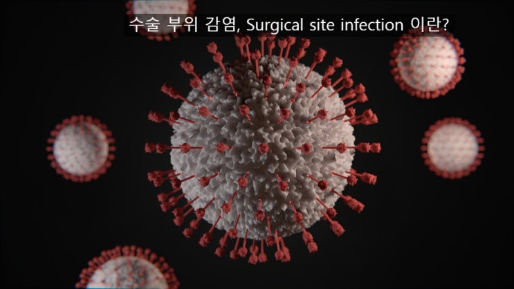  수술 전 예방적 항생제(preoperative prophylaxis antibiotics) 어떻게 주어야 하나? - 수술부위감염과 수술 감염 예방(종류, 시기, 지속기간)
