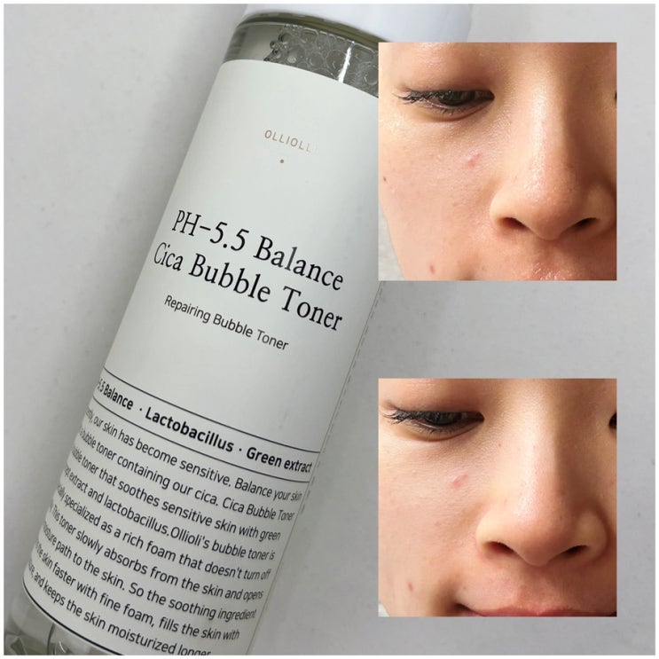 올리올리 수부지 약산성 시카버블토너추천, 토너팩 닦토 흡토에 좋음 올리올리 수부지 약산성 시카버블토너추천, 토너팩 닦토 흡토에 좋음