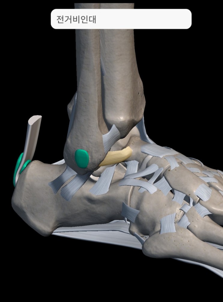 발목 염좌(ankle sprain) - 발목 염좌시 피해야 할 것들 - 안양역한의원