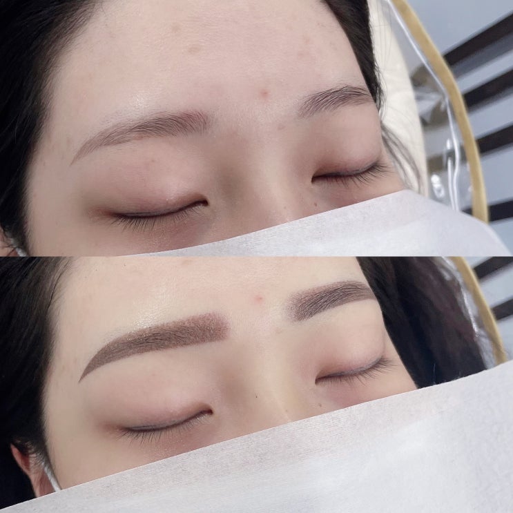  천안눈썹문신, 탈각 후 붉게 남은 눈썹이 고민이세요?