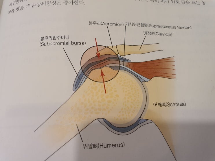  [이수역필라테스] 내가 어깨 사용을 많이 한다면?  어깨 충돌증후군(Impingement Syndrome) 관련 편