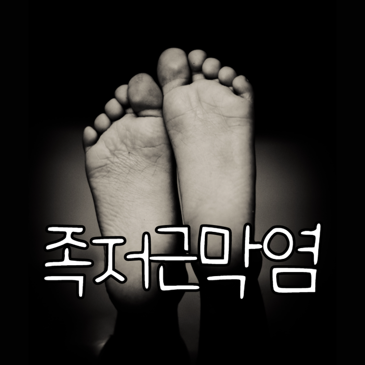  족막염 근저족막염 원인과 치료방법