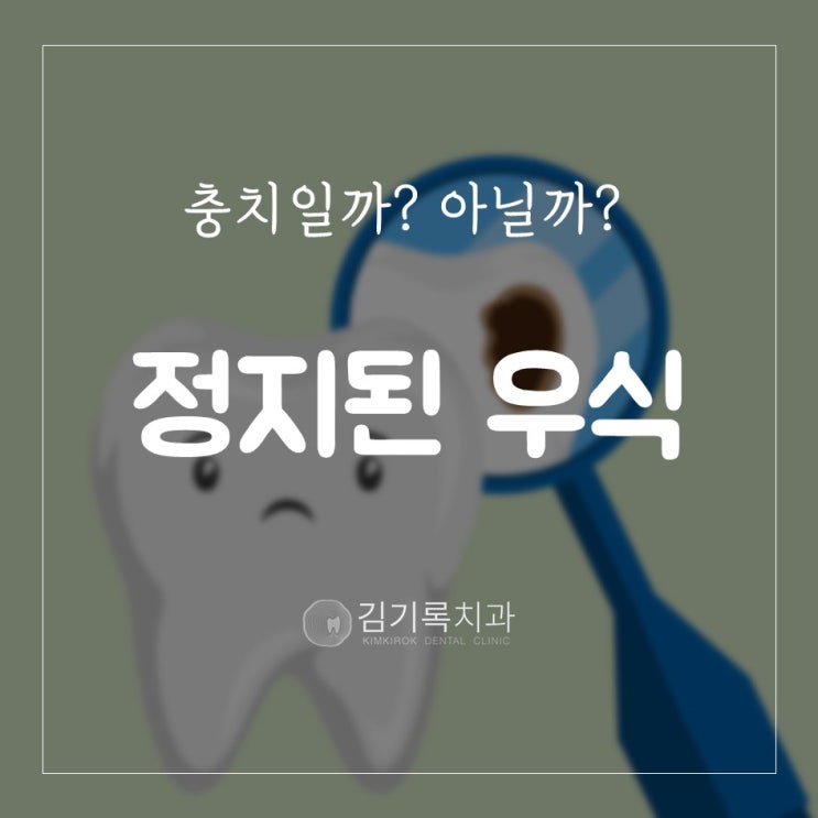 영통구 충치치료 치료 안하는 충치도 있다?! 정지된 우식과 진행중 우식