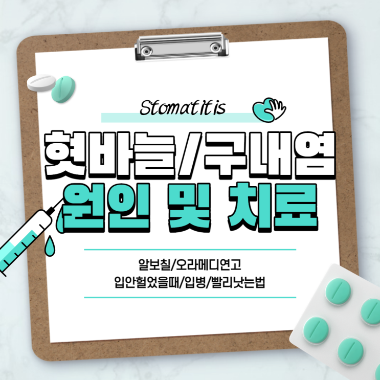  혓바늘, 구내염 빨리 낫는법 : 알보칠 / 오라메디 비교 【#구내염원인 #혓바늘원인 #구내염약 #입안헐었을때 #입병 #구내염연고 #오라메디연고】