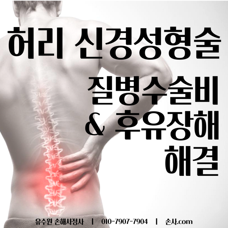  허리 유착박리술(신경성형술) 질병수술비 과연 지급 가능할까