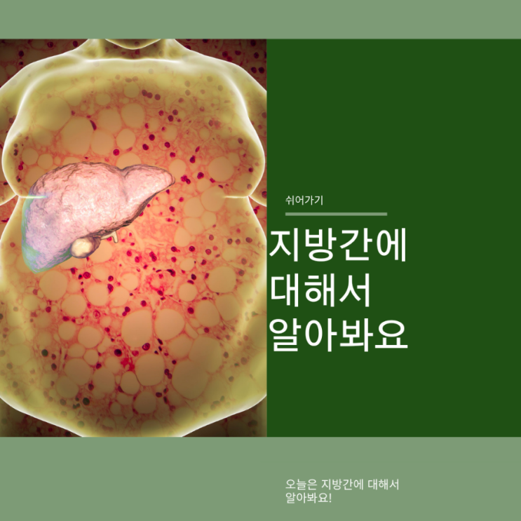  지방간에 대해서 알아봐요