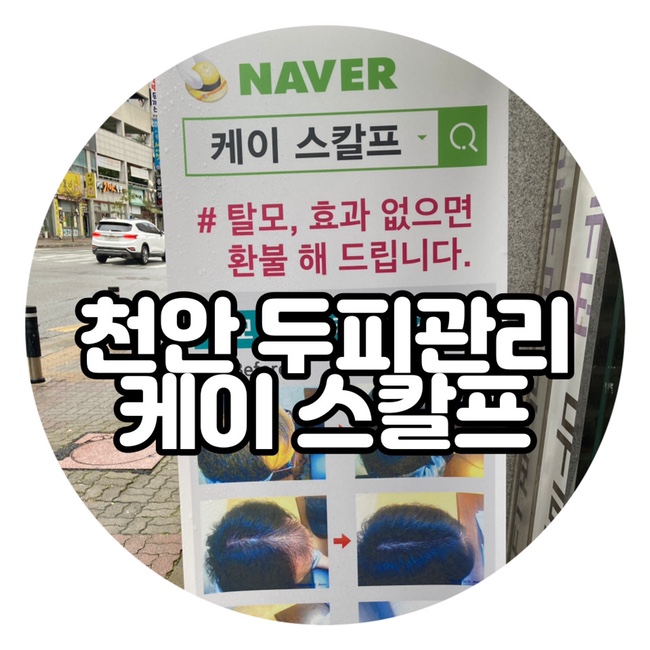  천안두피관리 K스칼프 탈모예방 두피스케일링의 중요성
