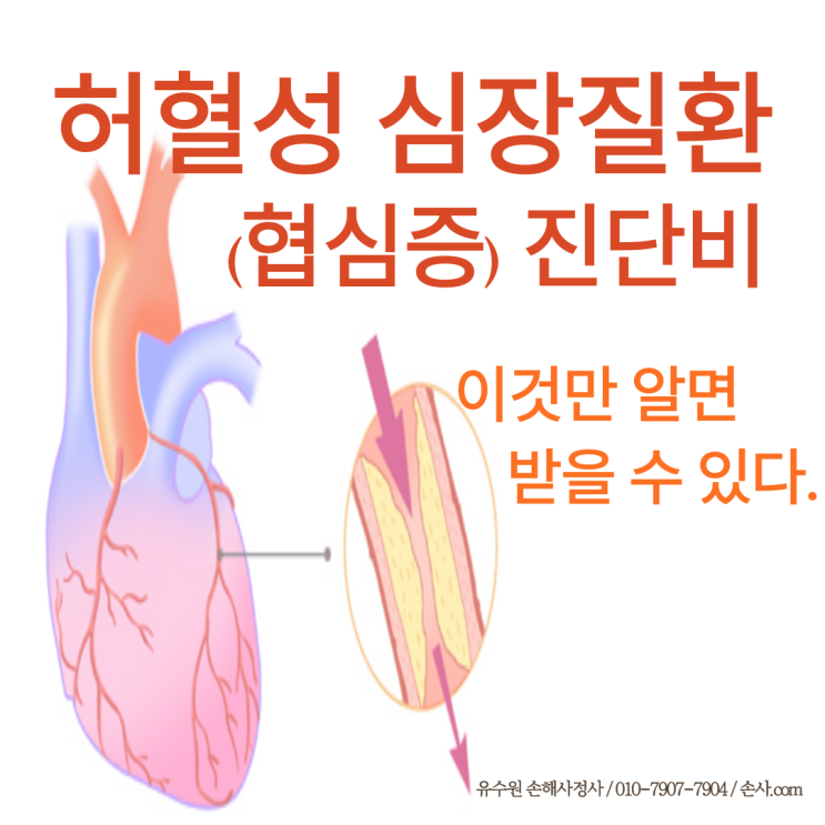  허혈성심장질환 진단비(협심증), 이것만 알면 보험금 받을 수 있습니다