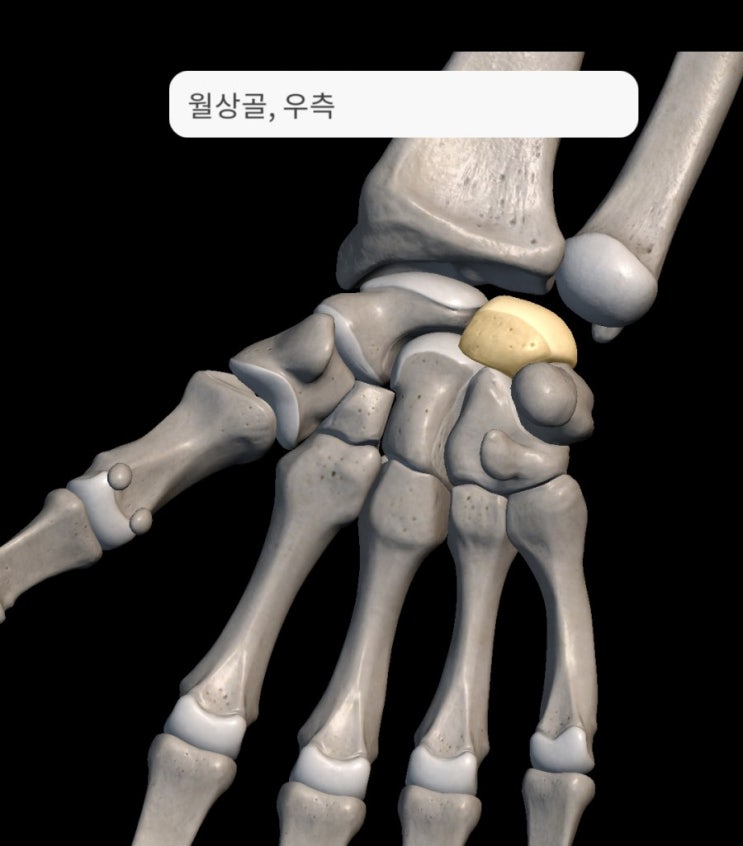 안양역한의원 - 손목 내측 통증, 새끼손가락 쪽 손목 통증, 척골 손목 통증(Ulnar Wrist Pain)