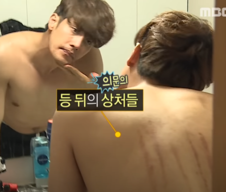 나혼자산다 성훈 키스마크, 하차 진실 나혼자산다 성훈 키스마크, 하차 진실