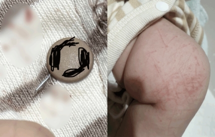  새로산 아기옷 속에 뾰족한 침이... 두달배기 상처에 업체 반응은?