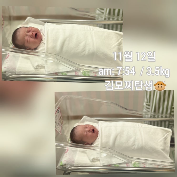  김모찌 No.18 선린자모의원 제왕절개 1일차 출산기록