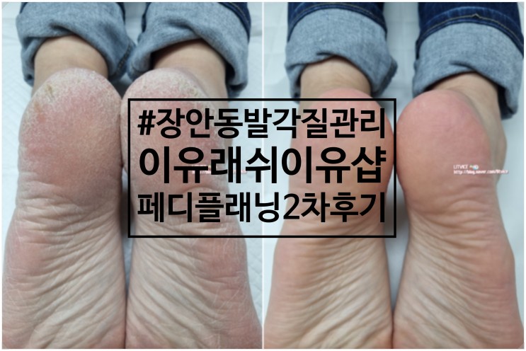 장안동발각질관리 이유래쉬이유샵 페디플래닝 2차후기(더 깨끗해진 뒤꿈치!)