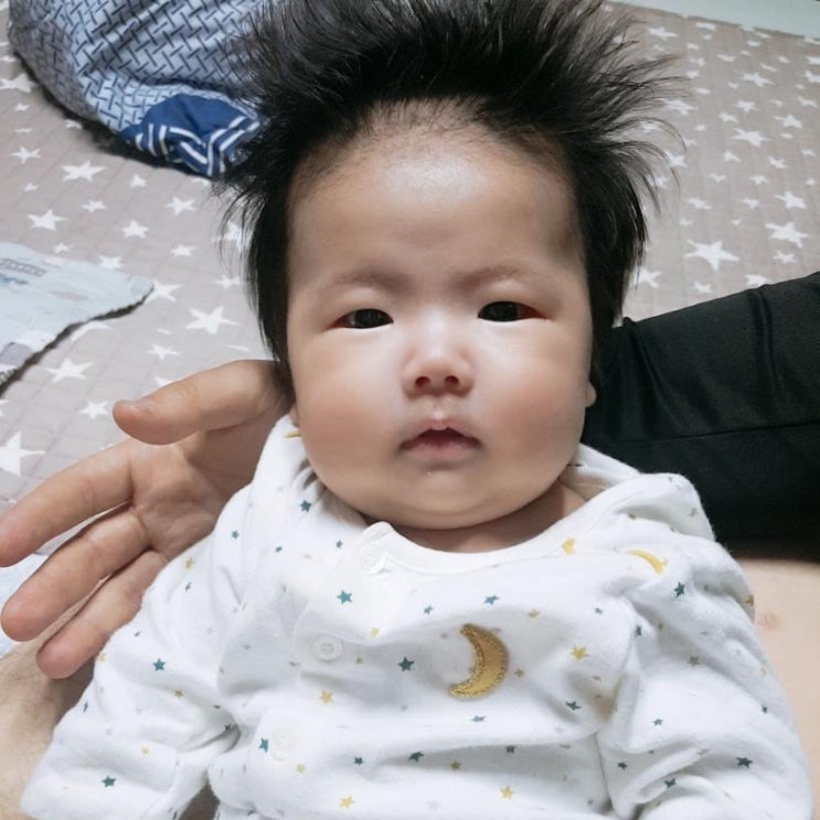  신생아 아기머리둘레 대두증 소두증 의심