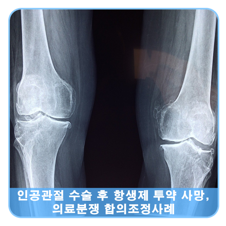  견관절 인공관절주위 감염 수술 및 약물 치료 후 사망, 합의조정사례