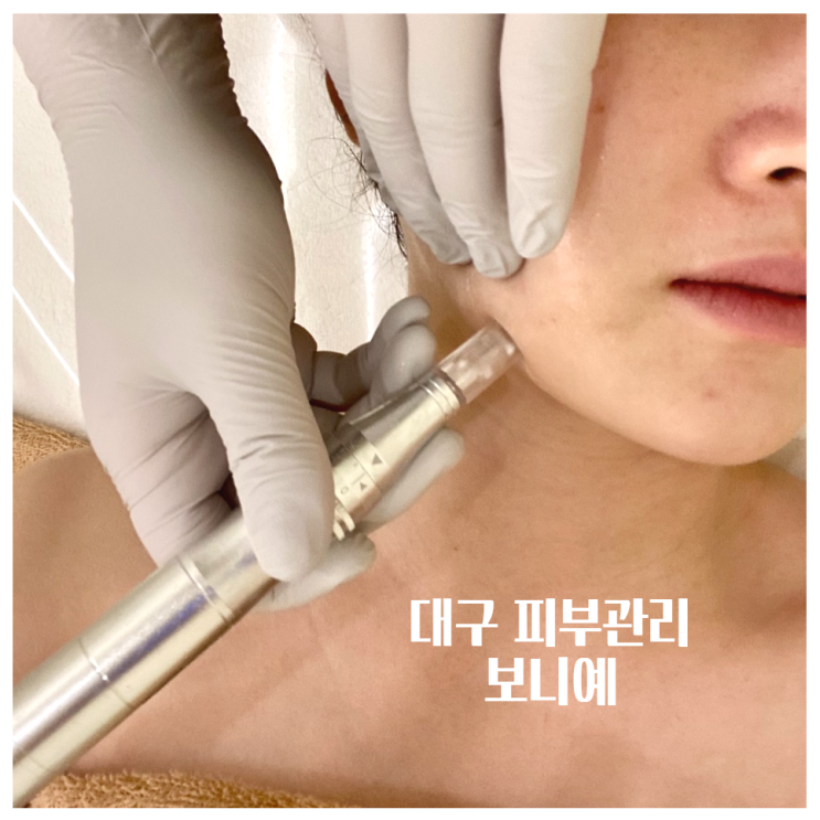 달서구 피부관리 / 월성동 보니예 / 고보습, 탄력 앰플관리 후기