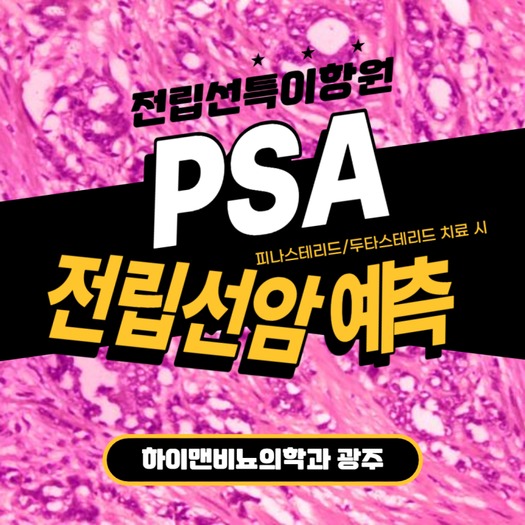  피나스테리드, 두타스테리드 치료 중인 전립선비대증 환자에서 혈중 PSA 농도 상승으로 전립선암 예측