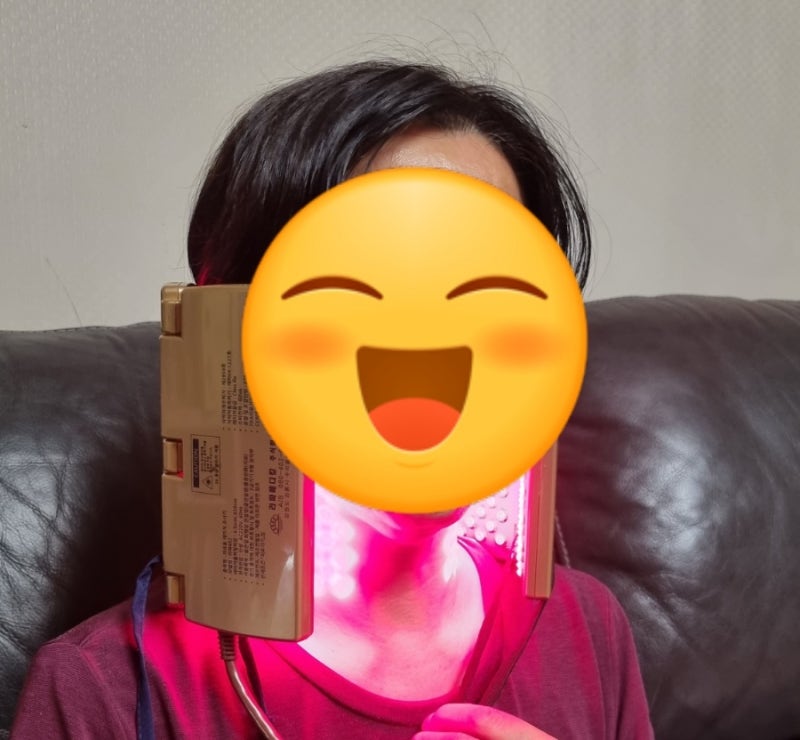 고막 천공 인공 고막 수술 (아산병원)