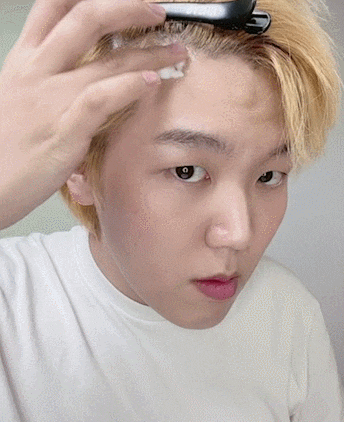  미녹시딜 성분의 탈모치료제 로게인폼 사용법과 효과
