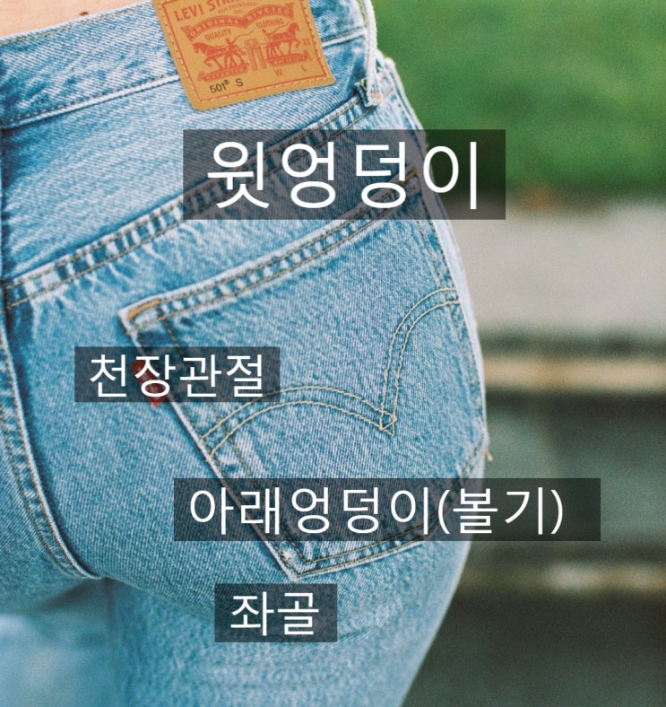  청라엉덩이통증 종아리까지 아파온다면 - 좌골신경통/좌골점액남염/천장관절증후군/이상근증후군 ?