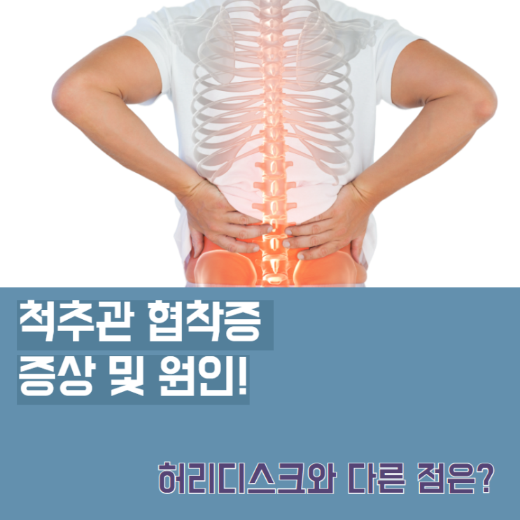  척추관 협착증 증상(허리 및 다리 통증)과 원인 및 허리디스크와 다른 점은?