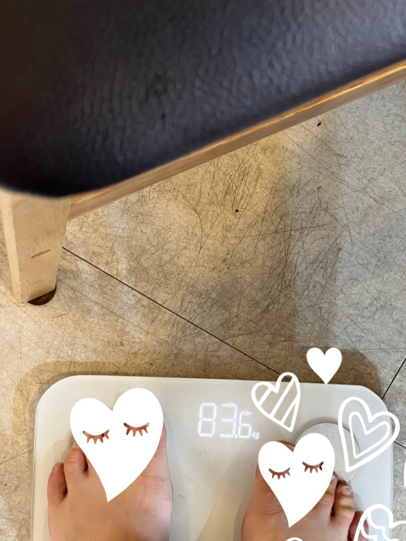 2.5kg감량 후 복부지방용융주사 효과 8