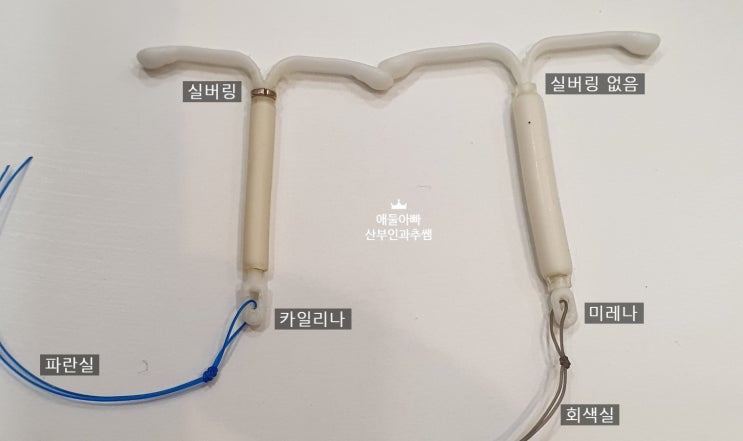  미레나... 이게 들어가진다고? 카일리나와 미레나 크기 분석 및  비용 차이