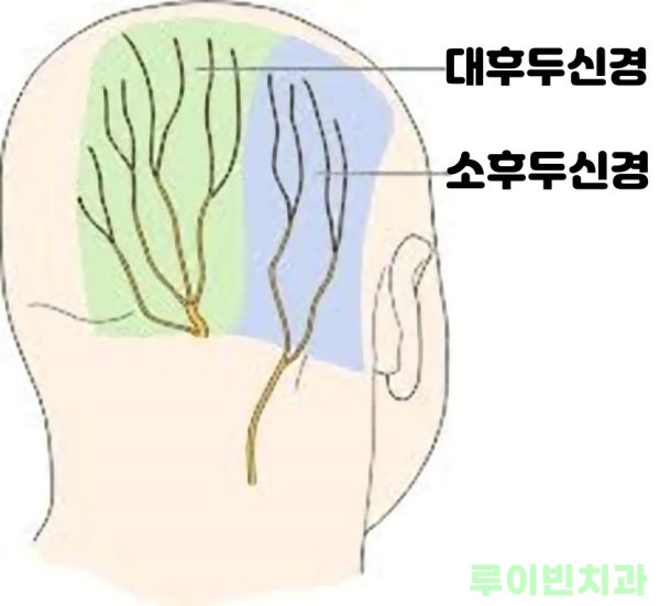 귀뒤 머리 통증 (왼쪽 오른쪽) 왜? 치료는? : 네이버 블로그 귀뒤 머리 통증 (왼쪽 오른쪽) 왜? 치료는? : 네이버 블로그