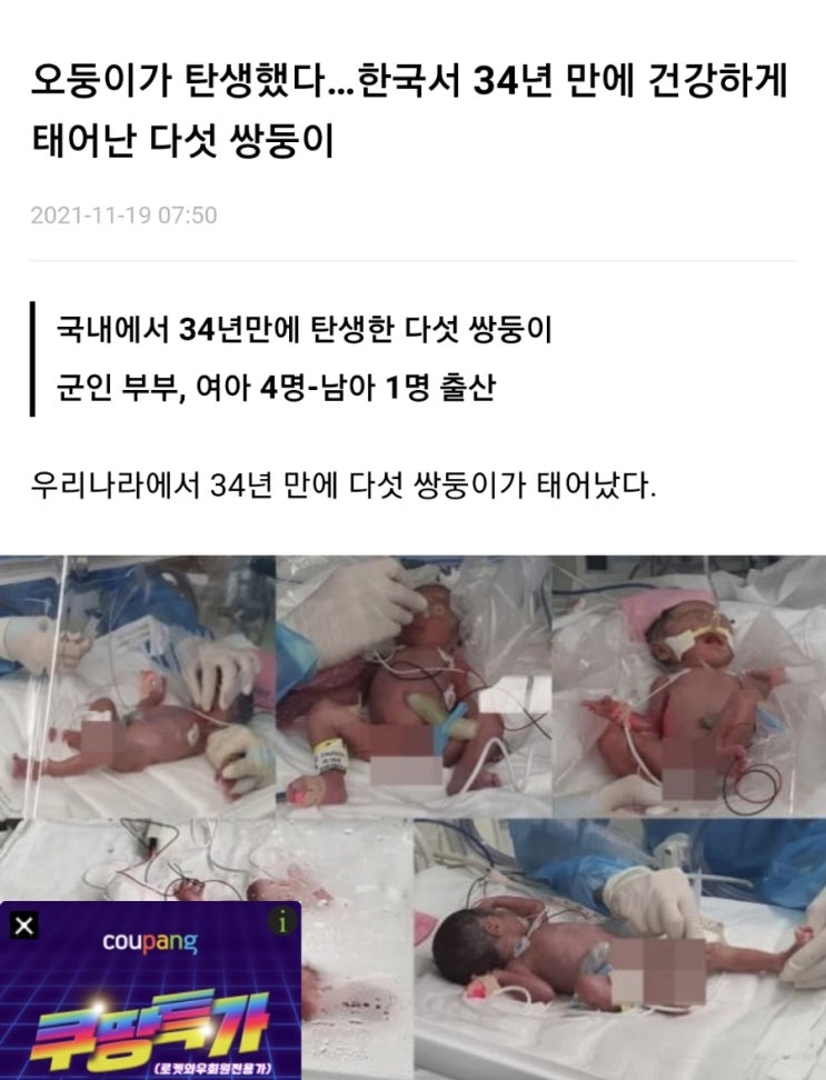  다섯 쌍둥이  출산!!!  일란성일까? 이란성일까? 오란성일까?
