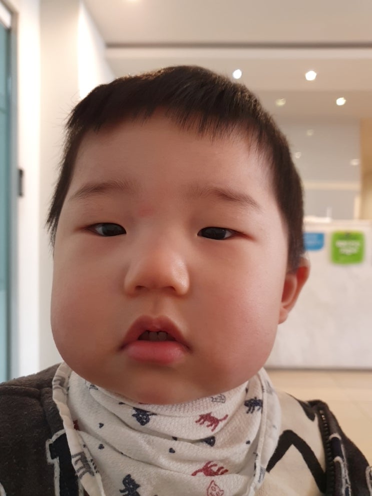  생후474일 :: 피부과 다녀옴