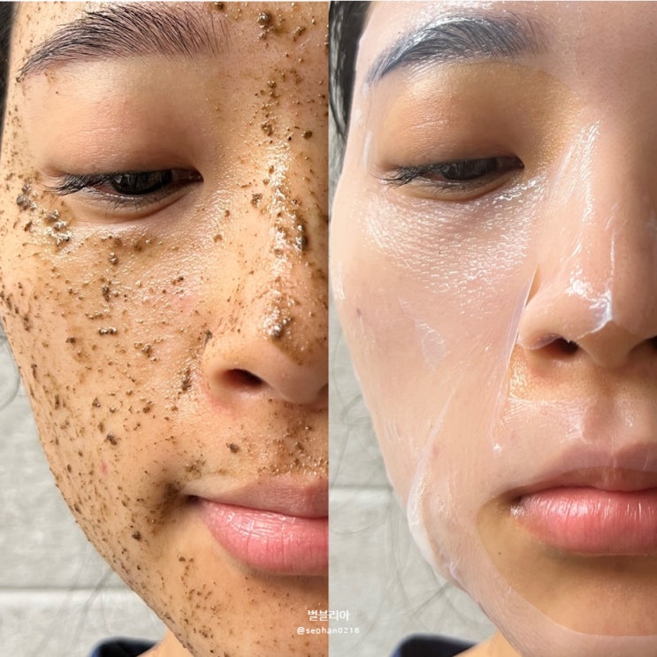 알라딘 헤클라필 셀프알라딘필링, 집에서 스피큘 해초필링으로 각질정리해본 후기 알라딘 헤클라필 셀프알라딘필링, 집에서 스피큘 해초필링으로 각질정리해본 후기