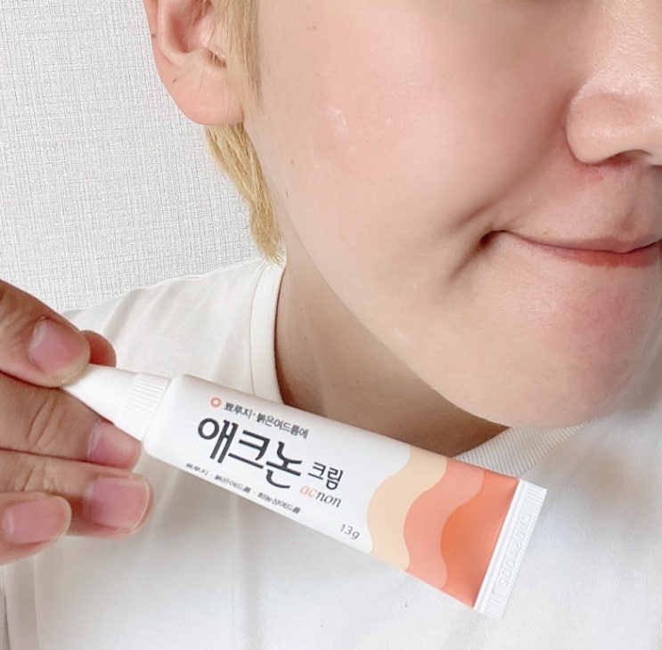  코밑 뾰루지?짜지 말고 애크논 크림