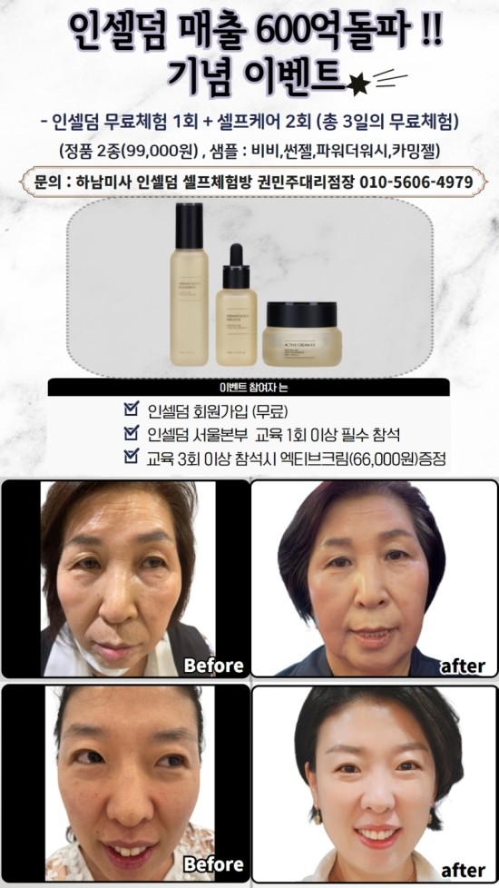 깨끗한피부만들기,인셀덤 무료 셀프체험,샘플신청 이벤트