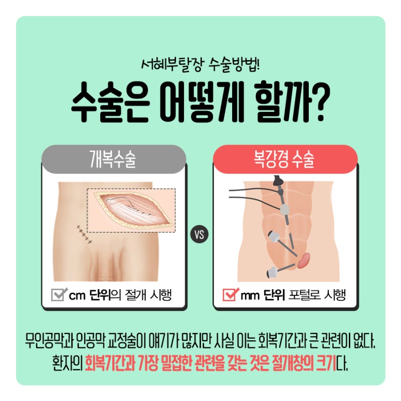 복강경 수술의 장단점, 일반 개복 수술 알아보기