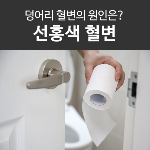  선홍색 혈변, 덩어리 혈변 원인은?