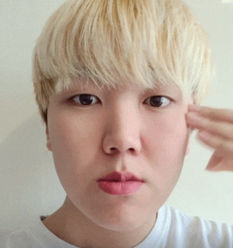  양악수술 준비 발치와 선교정 ! [2]