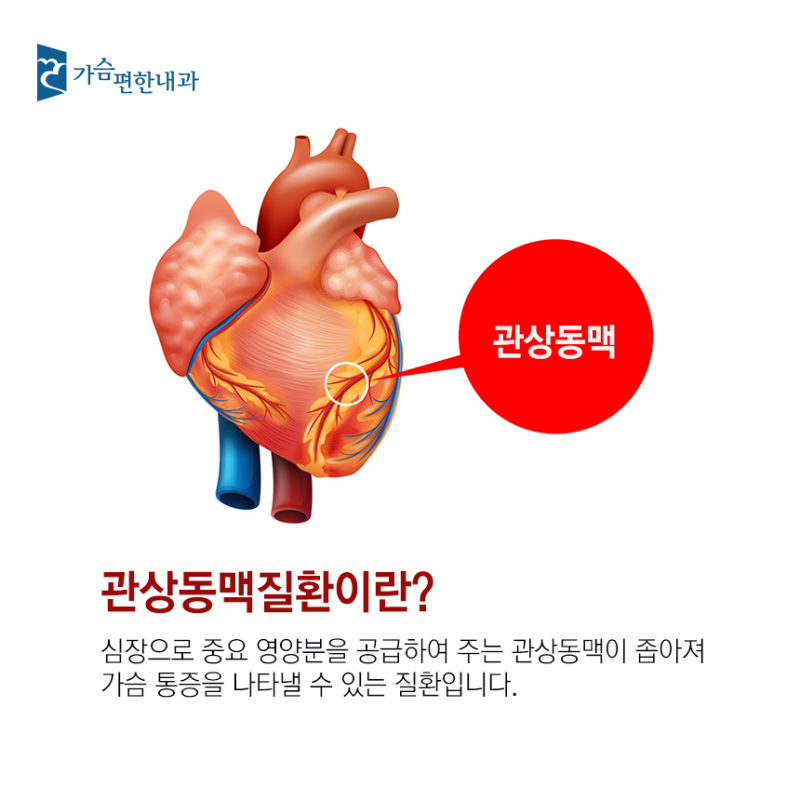 등산 중 발생할 수 있는 허혈성 심장질환 주의 필수 4