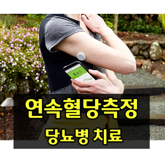  연속혈당측정이 당뇨병 최신 치료에서 갖는 중요성 2021 (ADA,KDA)