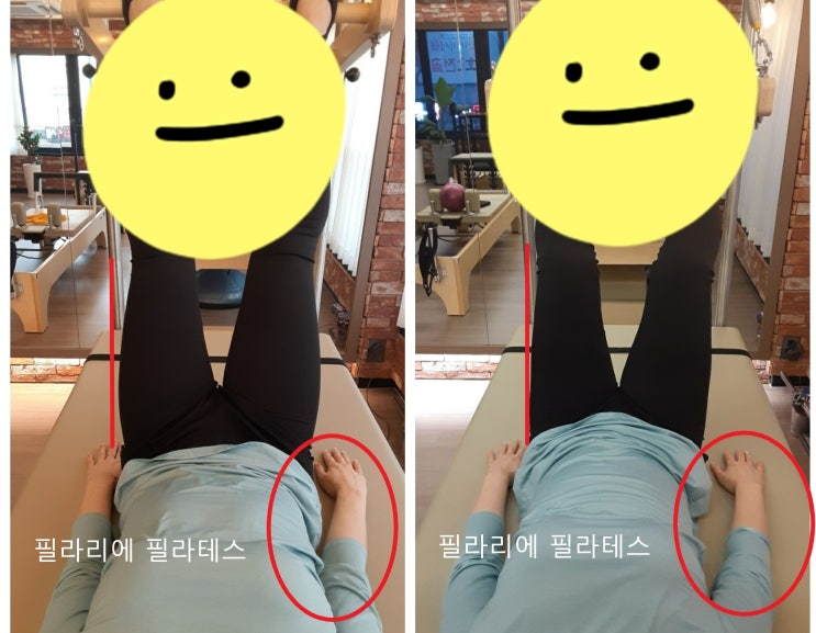 [이수필라테스] 손목이 왜 아플까요? 외반주 내반주